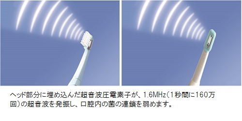 超音波歯ブラシとは